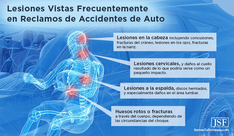 Cuatro lesiones comunes en accidentes automovilísticos, que se muestran en una figura de esqueleto humano