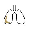 Black and gold lungs injured due to mesothelioma.