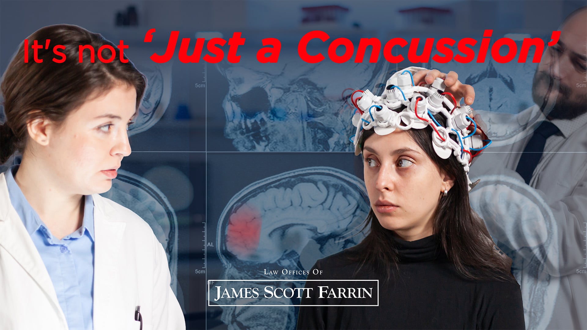 Traumatic Brain Injury Claims in South Carolina: What You Need to Know