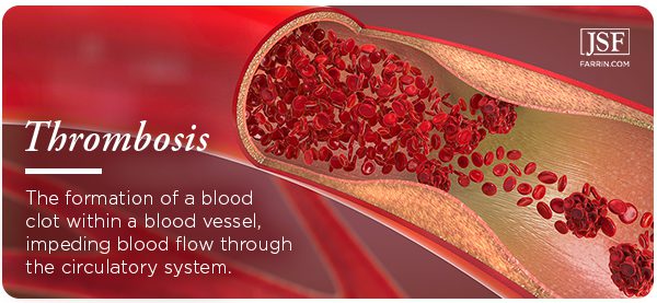 Thrombosis: when a blood clot has formed in a vessel, impeding blood flow.