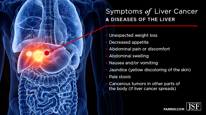 Symptoms of liver cancer may include weight loss, abdominal pain, jaundice or pale stools.