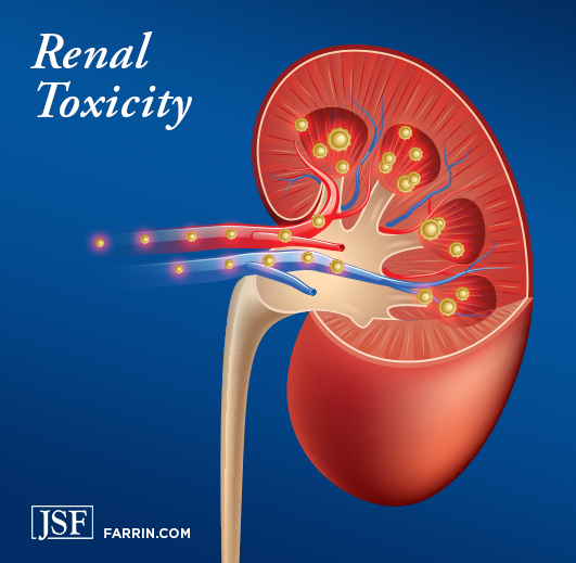 Toxins entering and attacking a human kidney.
