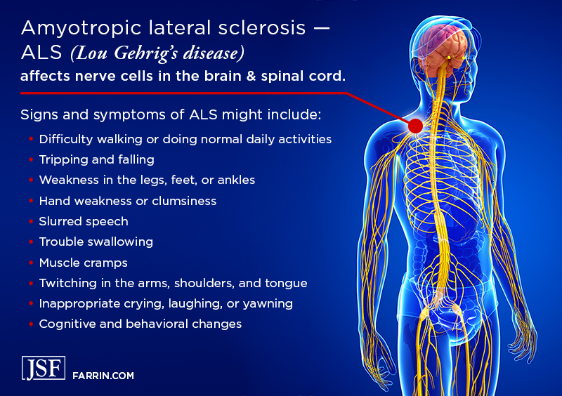 ALS (Lou Gehrig's disease) affects nerve cells in the brain & spinal cord.