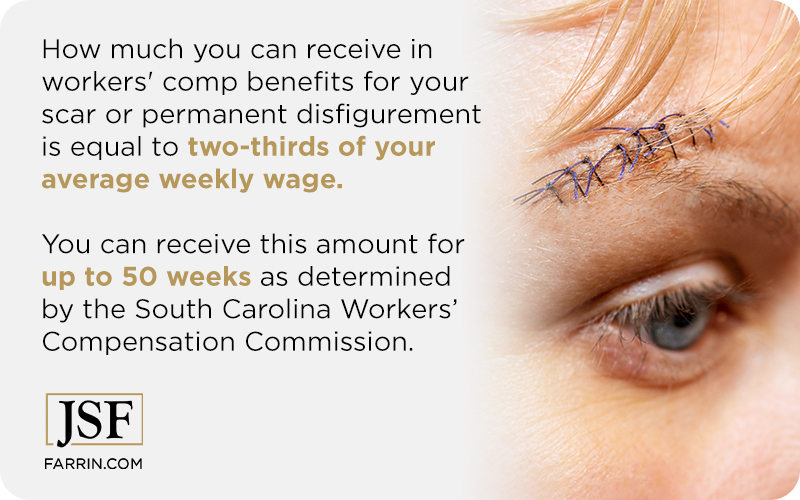 How much you can receive in WC benefits for your disfigurement = 2/3 of your average weekly wage.