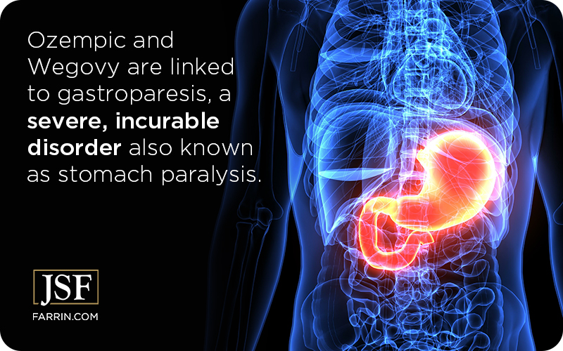 Gastroparesis or stomach paralysis is a severe, permanent condition with no cure.