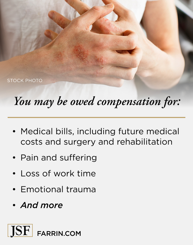 Law Offices of James Scott Farrin litigation attorneys. Doctor examines severe eczema or skin irritation on patient’s arm during medical evaluation.