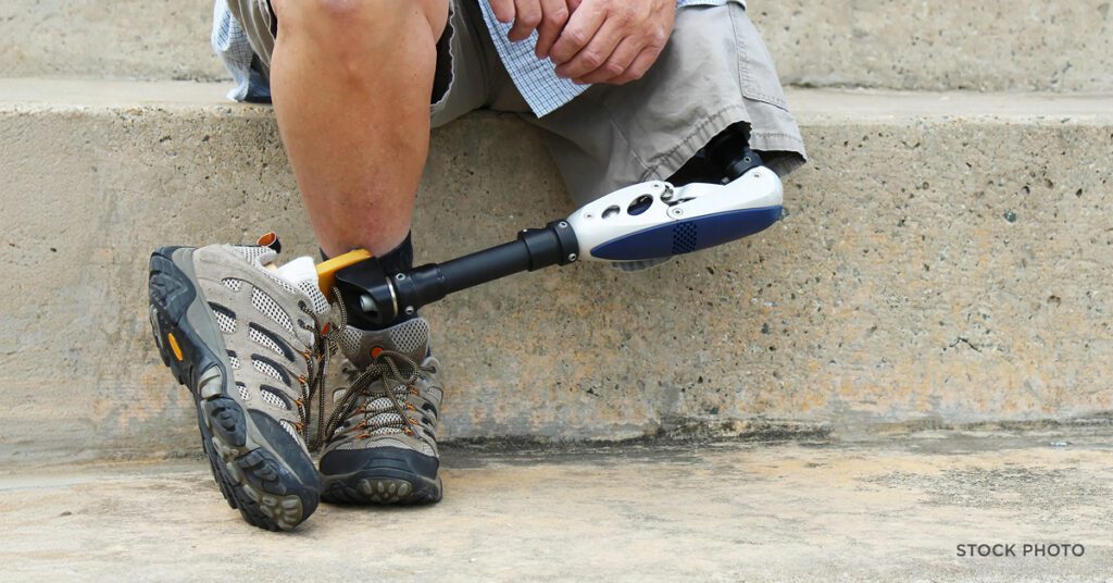 Law Offices of James Scott Farrin North Carolina workers’ compensation attorneys. Worker with prosthetic leg sits on steps after serious workplace injury.